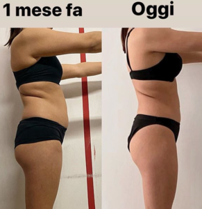 prima e dopo 